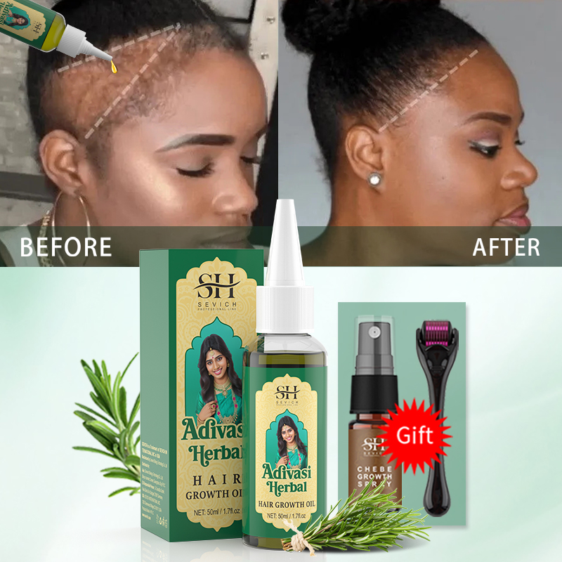 Ayurvedic Hair Growth Oil Indi - Hair Care Fragrance Essential Oil บทวิจารณ์และราคา