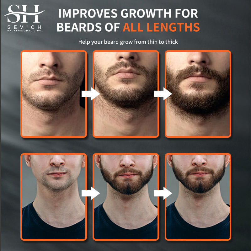 Sevich Men Beard Growth Essent - Hair Care Serum บทวิจารณ์และราคา