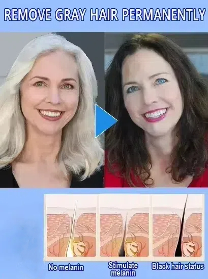 White hair killer, remove gray - Hair Care Natural Products บทวิจารณ์และราคา