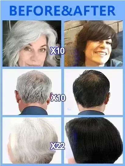 White hair killer, remove gray - Hair Care Natural Products บทวิจารณ์และราคา