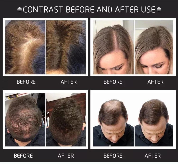 28g Hair Building Fibers come  - Hair Care Natural Products บทวิจารณ์และราคา
