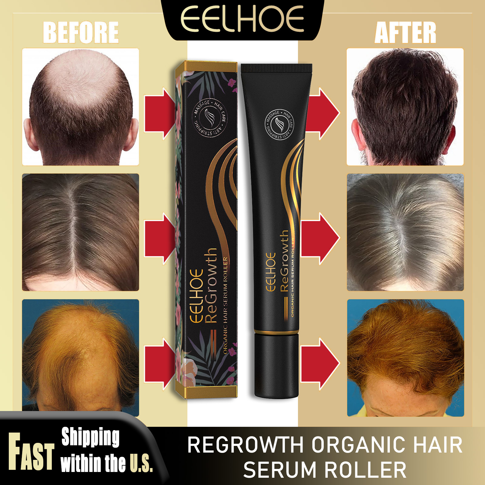 EELHOE Regrowth Hair Serum Wit - Hair Care Natural Products บทวิจารณ์และราคา