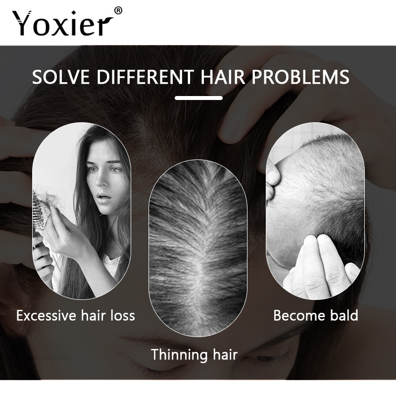 Intensive Growth Serum Prevent - Hair Care Serum บทวิจารณ์และราคา