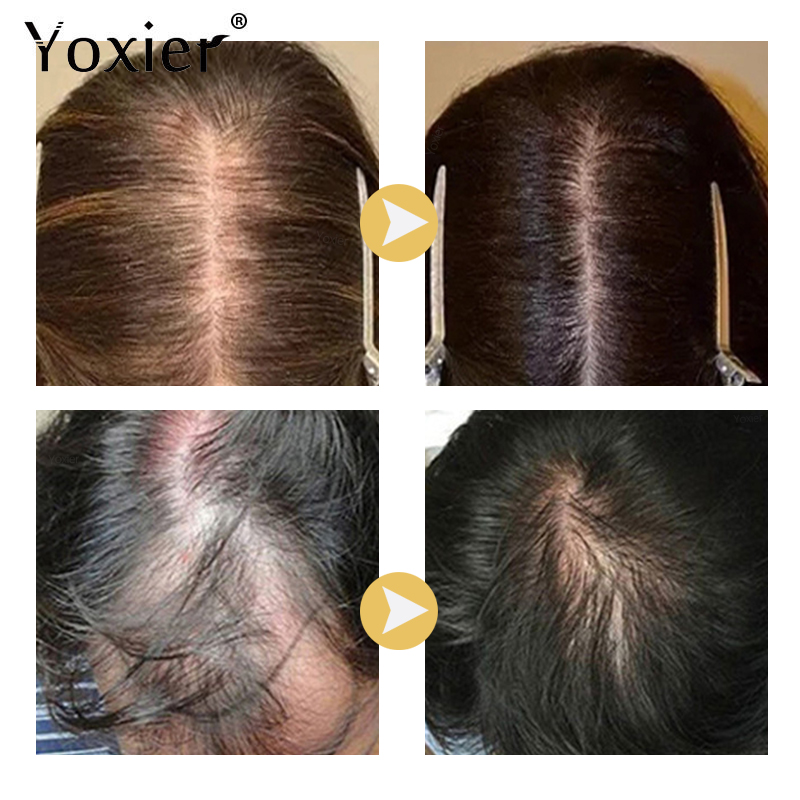 Intensive Growth Serum Prevent - Hair Care Serum บทวิจารณ์และราคา