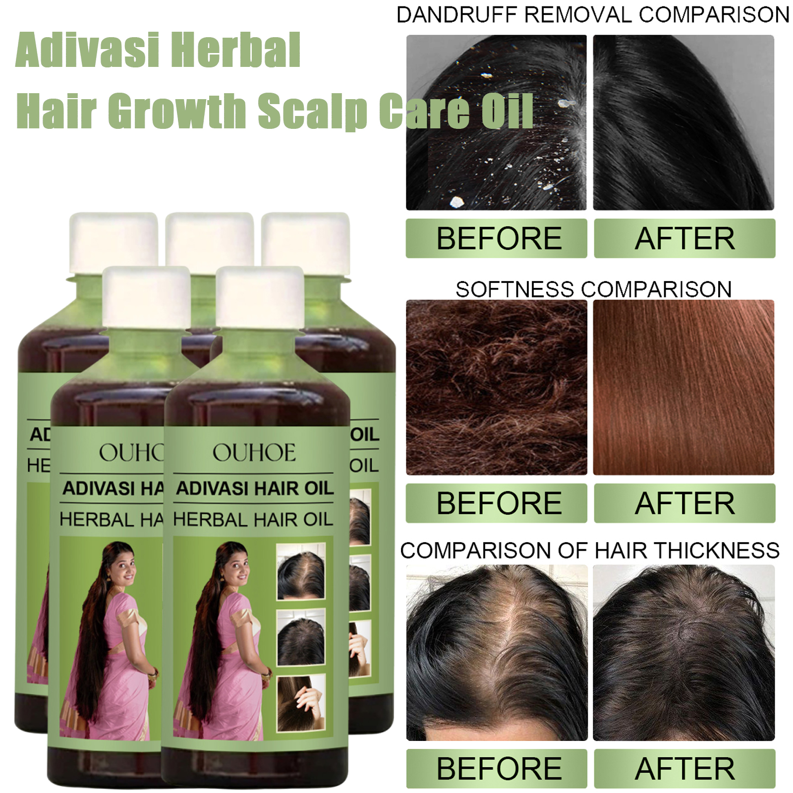100ml Hair Growth Oil India Ad - Hair Care Ouai บทวิจารณ์และราคา