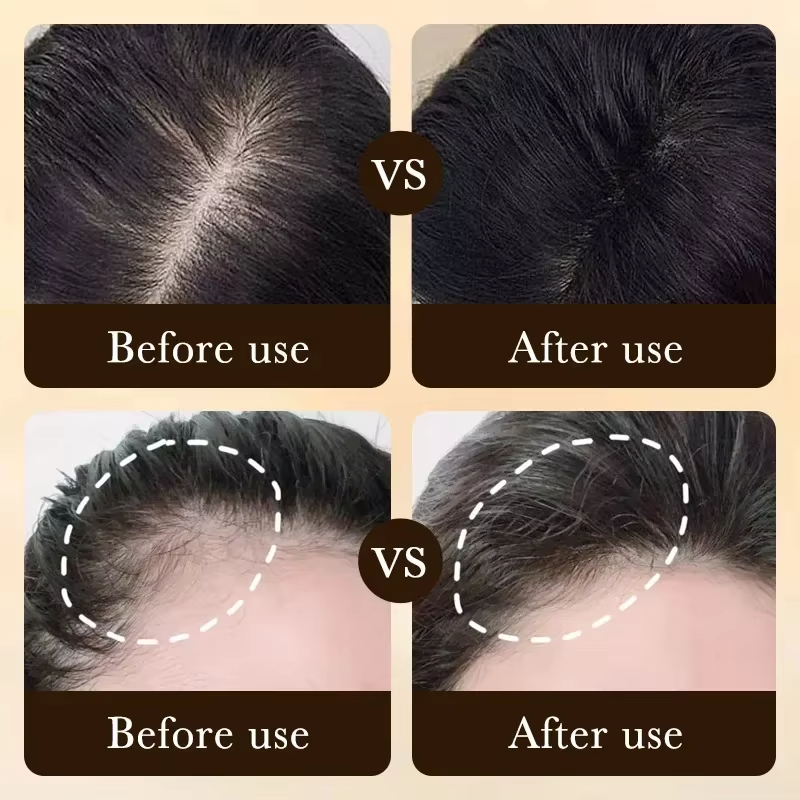 One-stop hair care: Solve basi - Hair Care Basic บทวิจารณ์และราคา