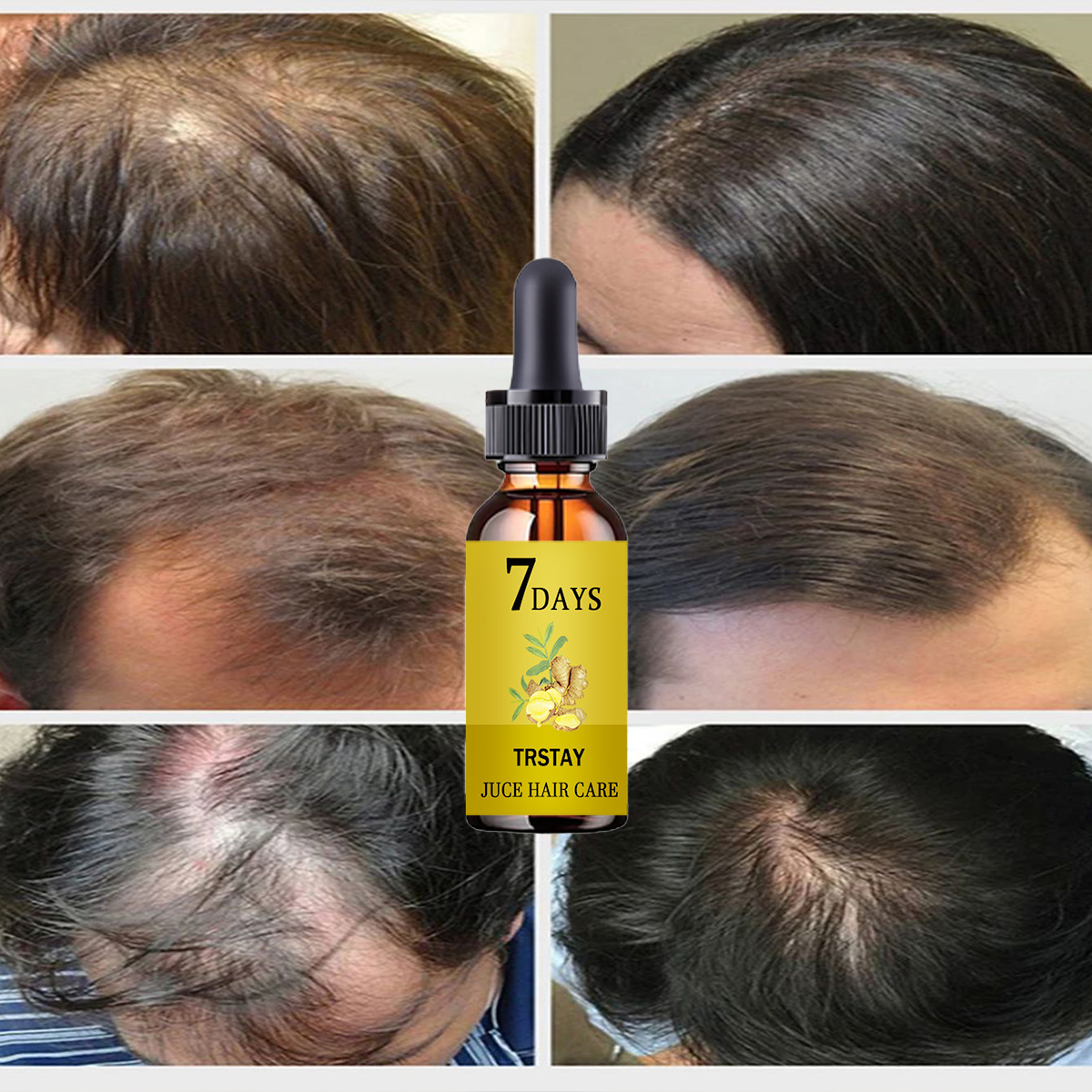 All Hair Types Friendly At-Hom - Hair Care Basic บทวิจารณ์และราคา