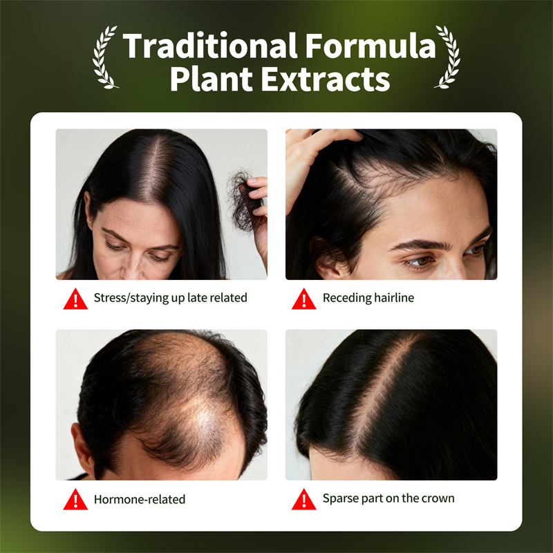 Natural Hair Growth Set Usman  - Hair Care Natural Products บทวิจารณ์และราคา