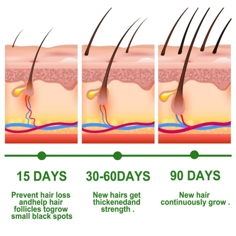 Hair Growth Serum Fast Growing - Hair Care Fragrance Essential Oil บทวิจารณ์และราคา