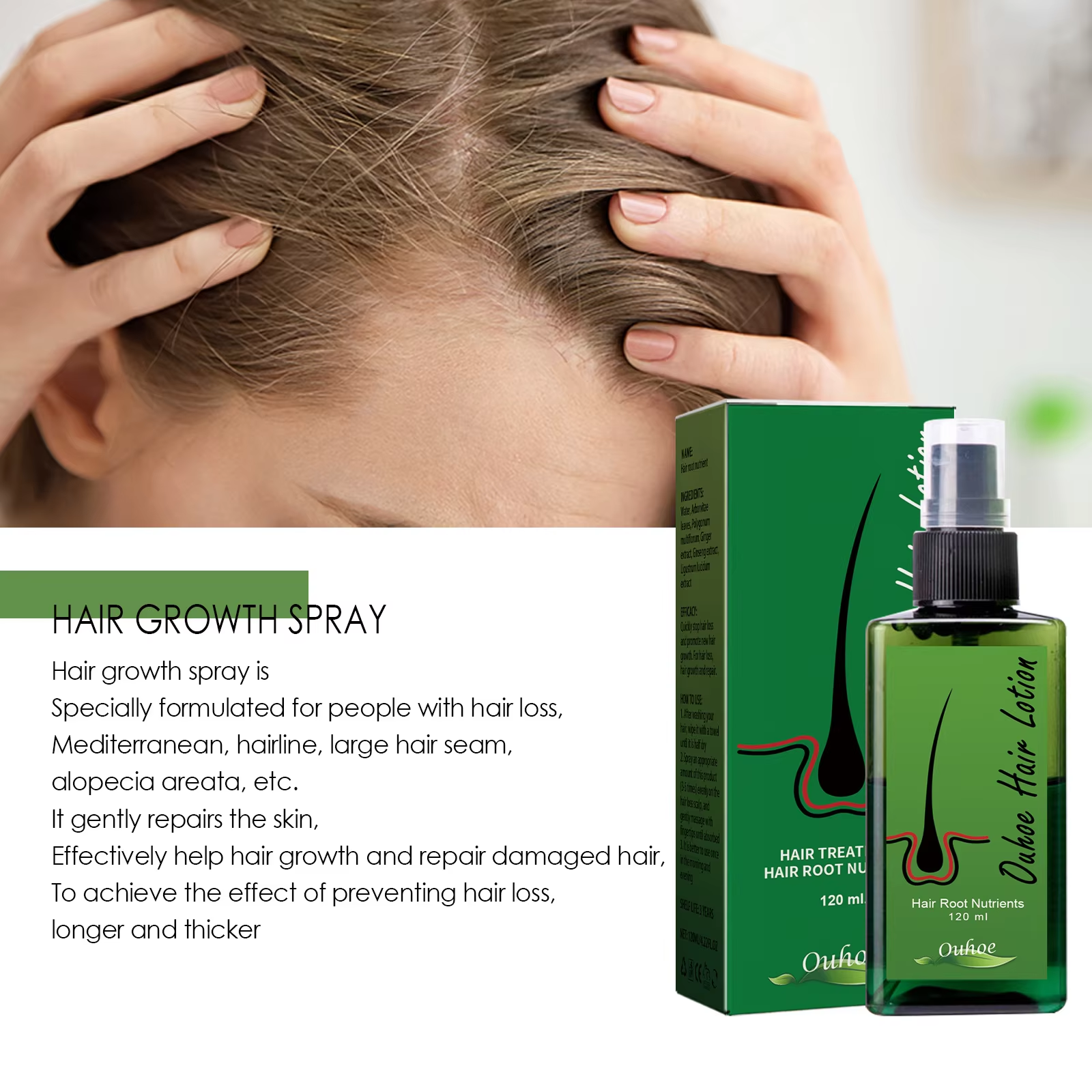 Hair Growth Spray Anti Hair Lo - Hair Care Serum บทวิจารณ์และราคา