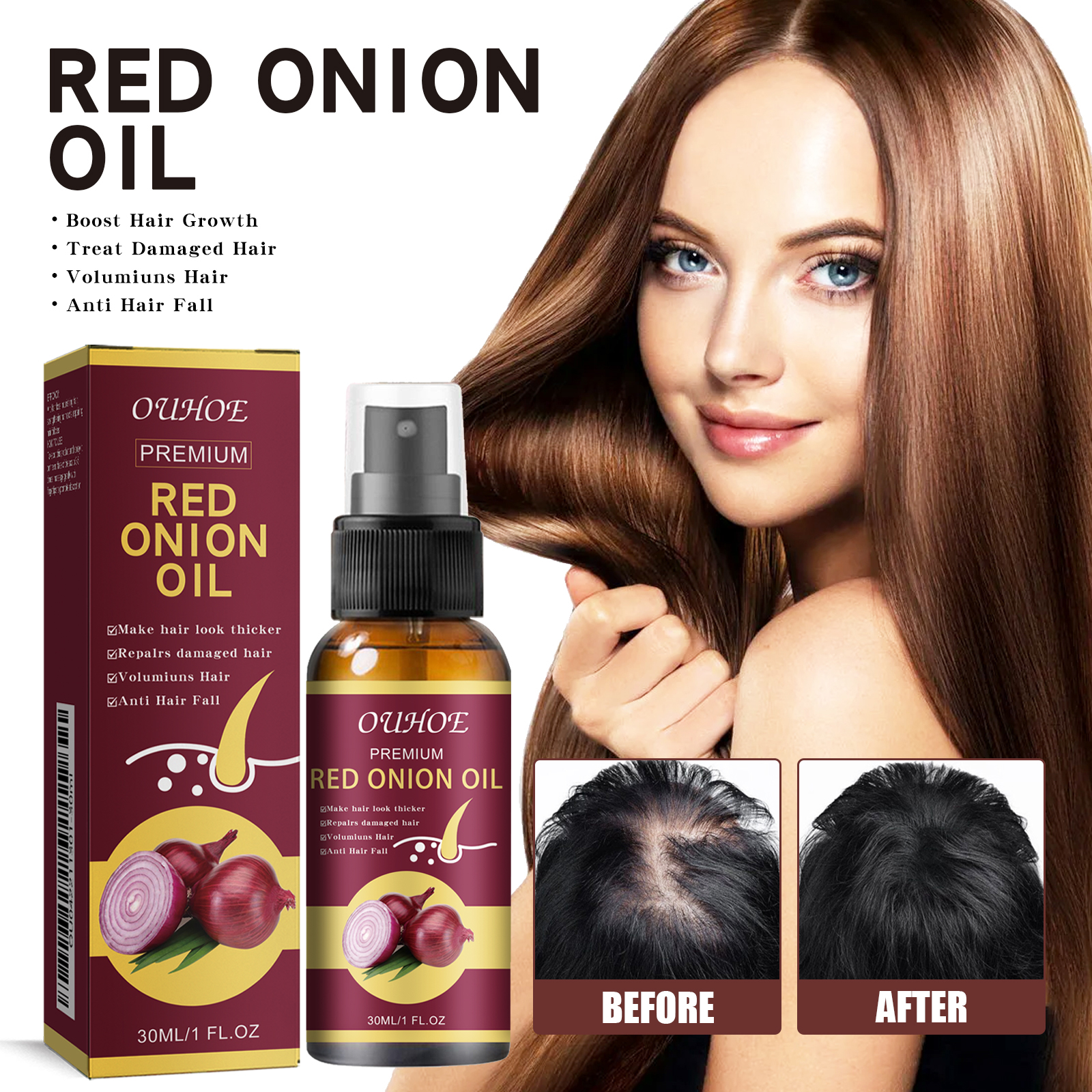 Red Onion Hair Growth Essentia - Hair Care Ouai บทวิจารณ์และราคา
