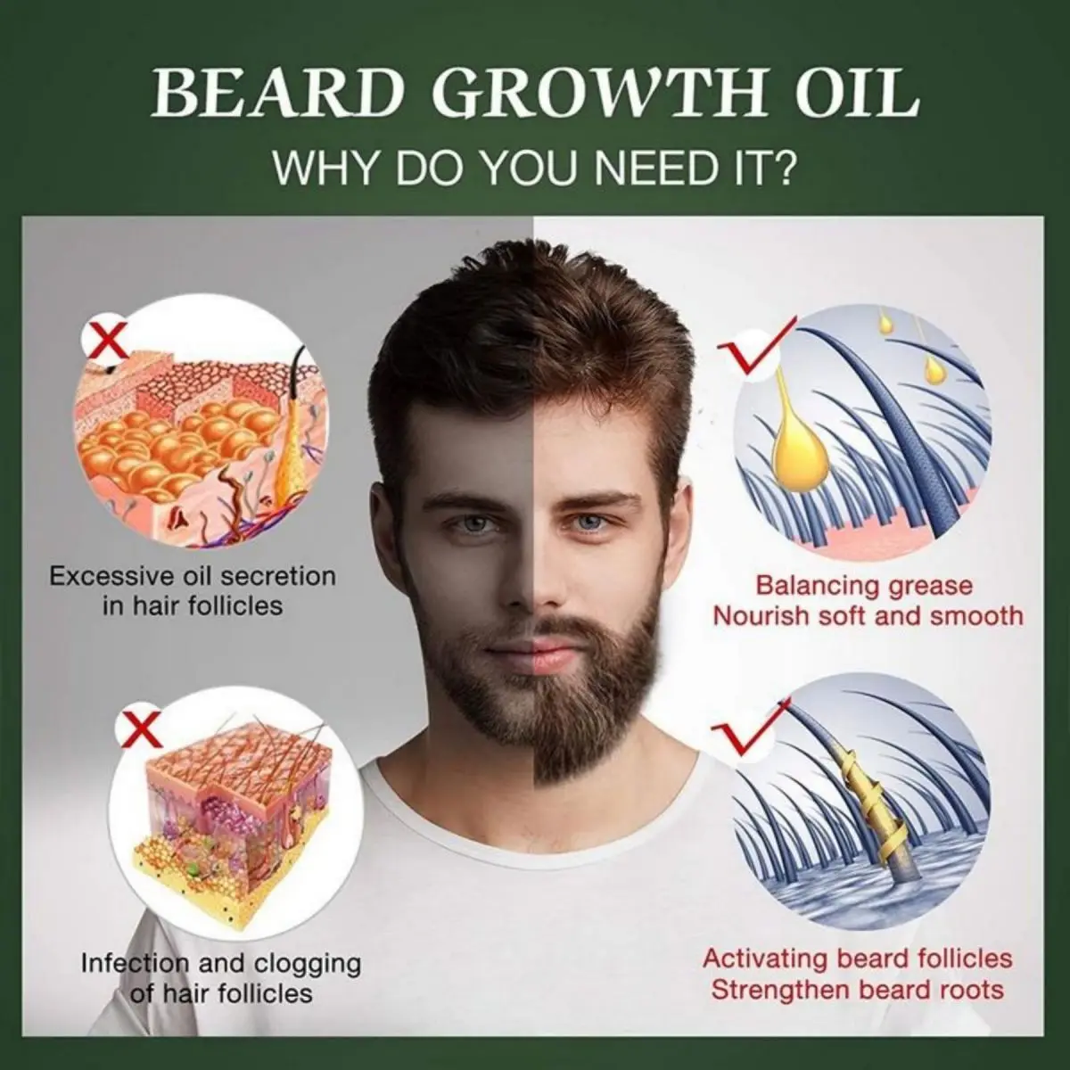 Fast Beard Growth Oil Beard Oi - Hair Care Fragrance Essential Oil บทวิจารณ์และราคา