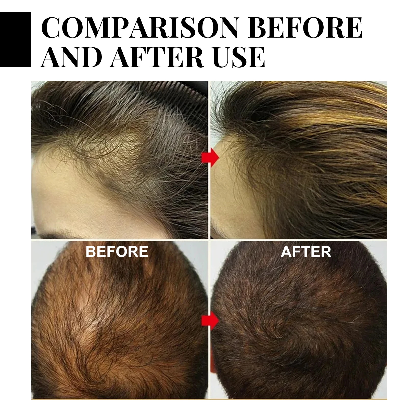 Ginger Hair Growth spray Anti  - Hair Care Natural Products บทวิจารณ์และราคา