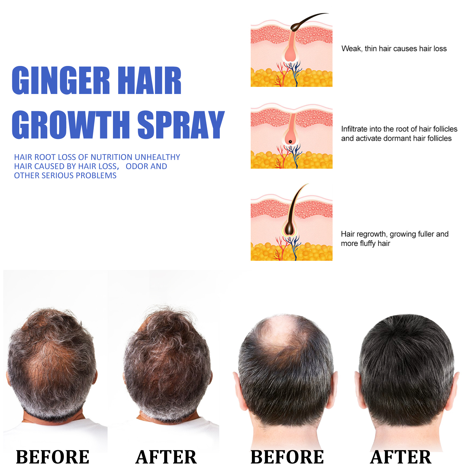 Ginger Hair Growth spray Anti  - Hair Care Natural Products บทวิจารณ์และราคา