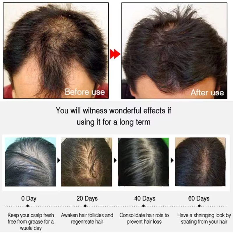 Ginger Hair Growth spray Anti  - Hair Care Natural Products บทวิจารณ์และราคา