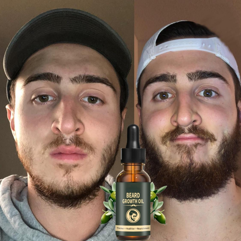 Fast Beard Growth Oil Beard Oi - Hair Care Fragrance Essential Oil บทวิจารณ์และราคา