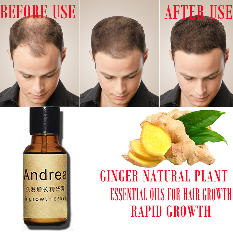 2/5/10Pcs Andrea Hair Growth S - Hair Care Fragrance Essential Oil บทวิจารณ์และราคา