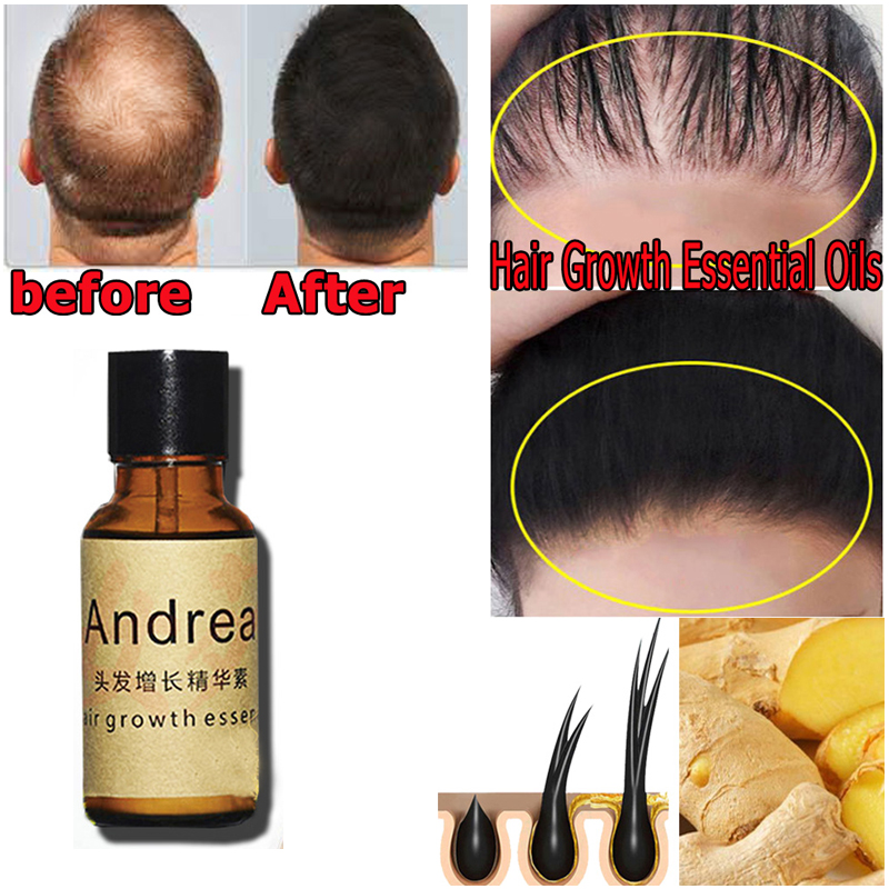 2/5/10Pcs Andrea Hair Growth S - Hair Care Fragrance Essential Oil บทวิจารณ์และราคา